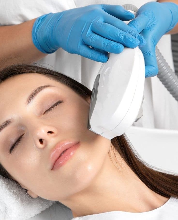 IPL Skin Rejuvenation