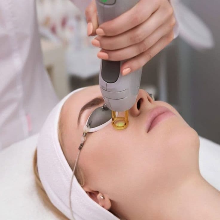Advanced Skin Resurfacing Laser