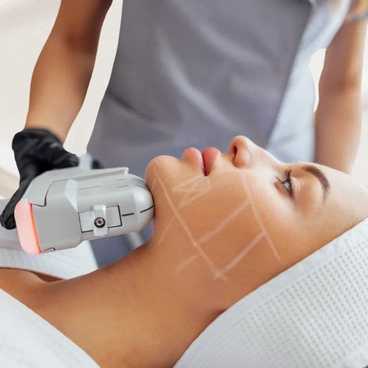 Jawline & Double Chin Contouring