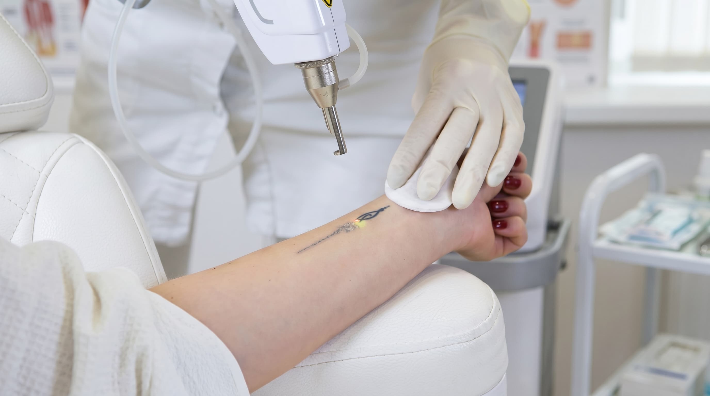 Laser Tattoo Removal